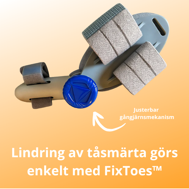 FixToes™ – Slipp hallux valgus utan operation