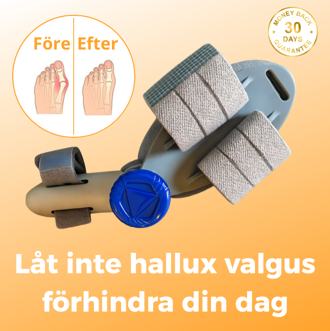 FixToes™ – Slipp hallux valgus utan operation